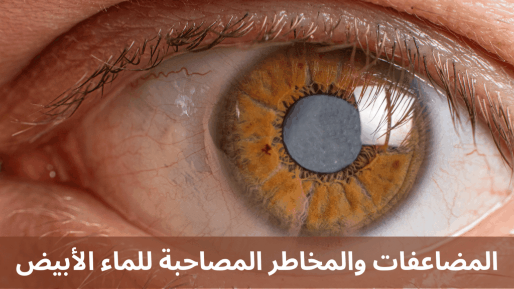 المضاعفات والمخاطر المصاحبة للماء الأبيض